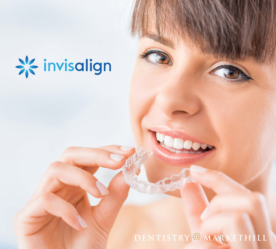 Woman inserting clear invisalign aligner