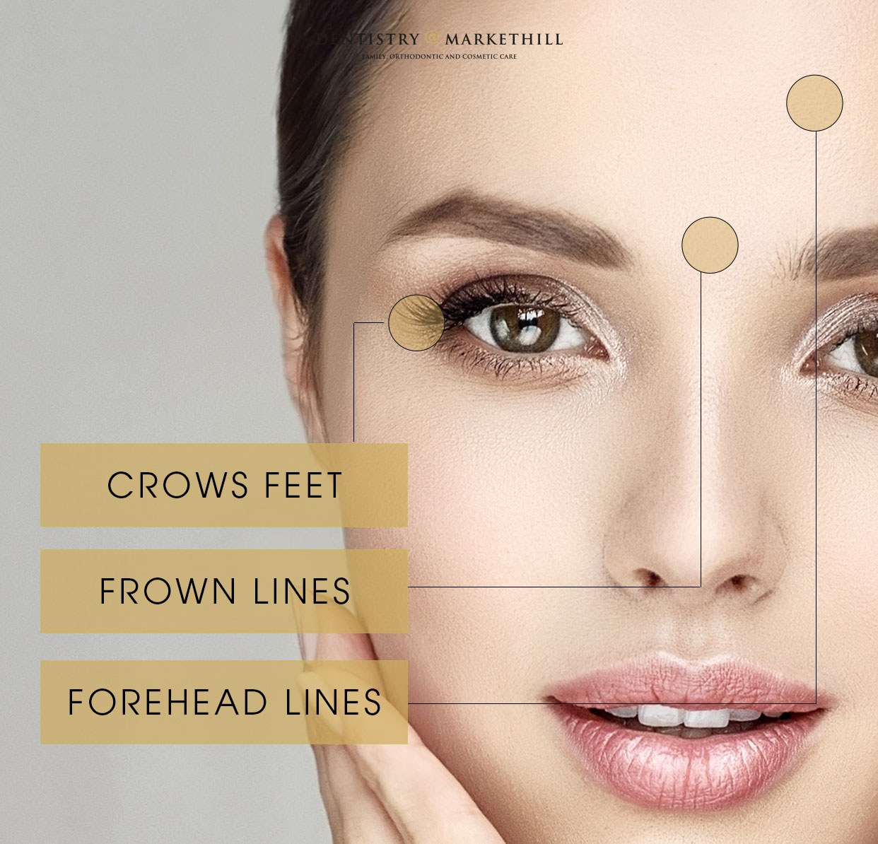 Image of facial areas which tend to wrinkle
